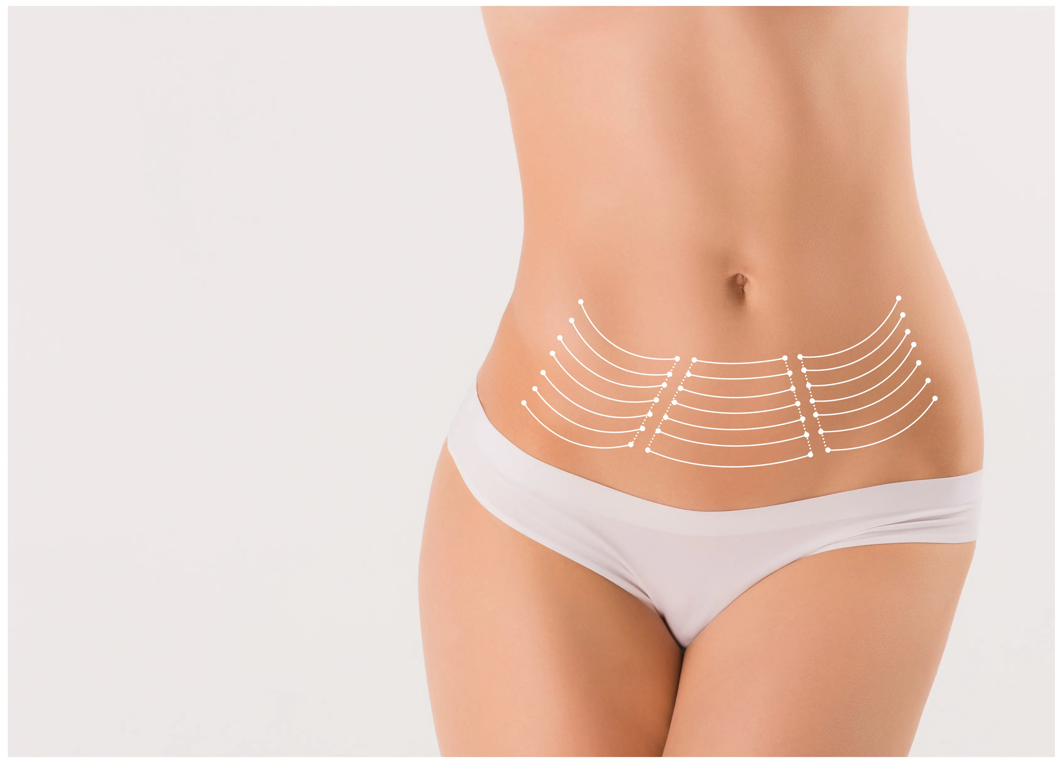 Brazilian Butt Lift - ανόρθωση γλουτών με μεταφορά λίπους