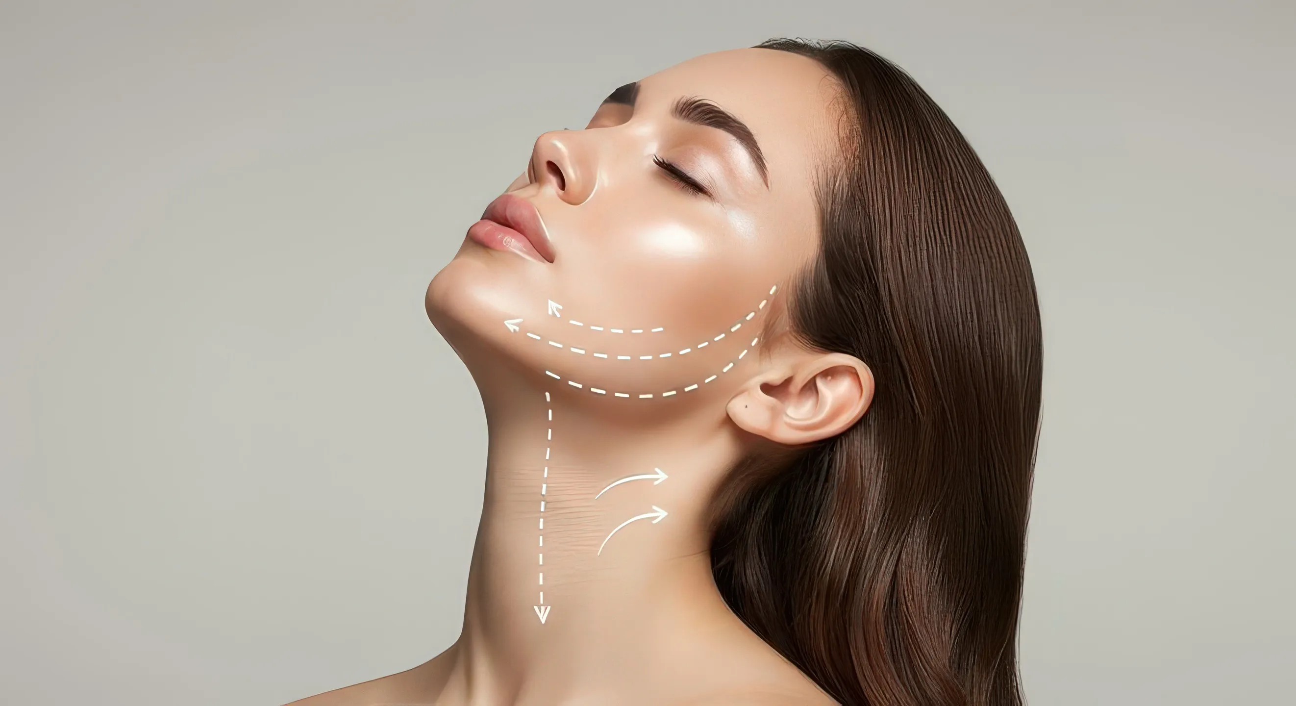 Lifting λαιμού (Neck Lift) - σύσφιξη λαιμού
