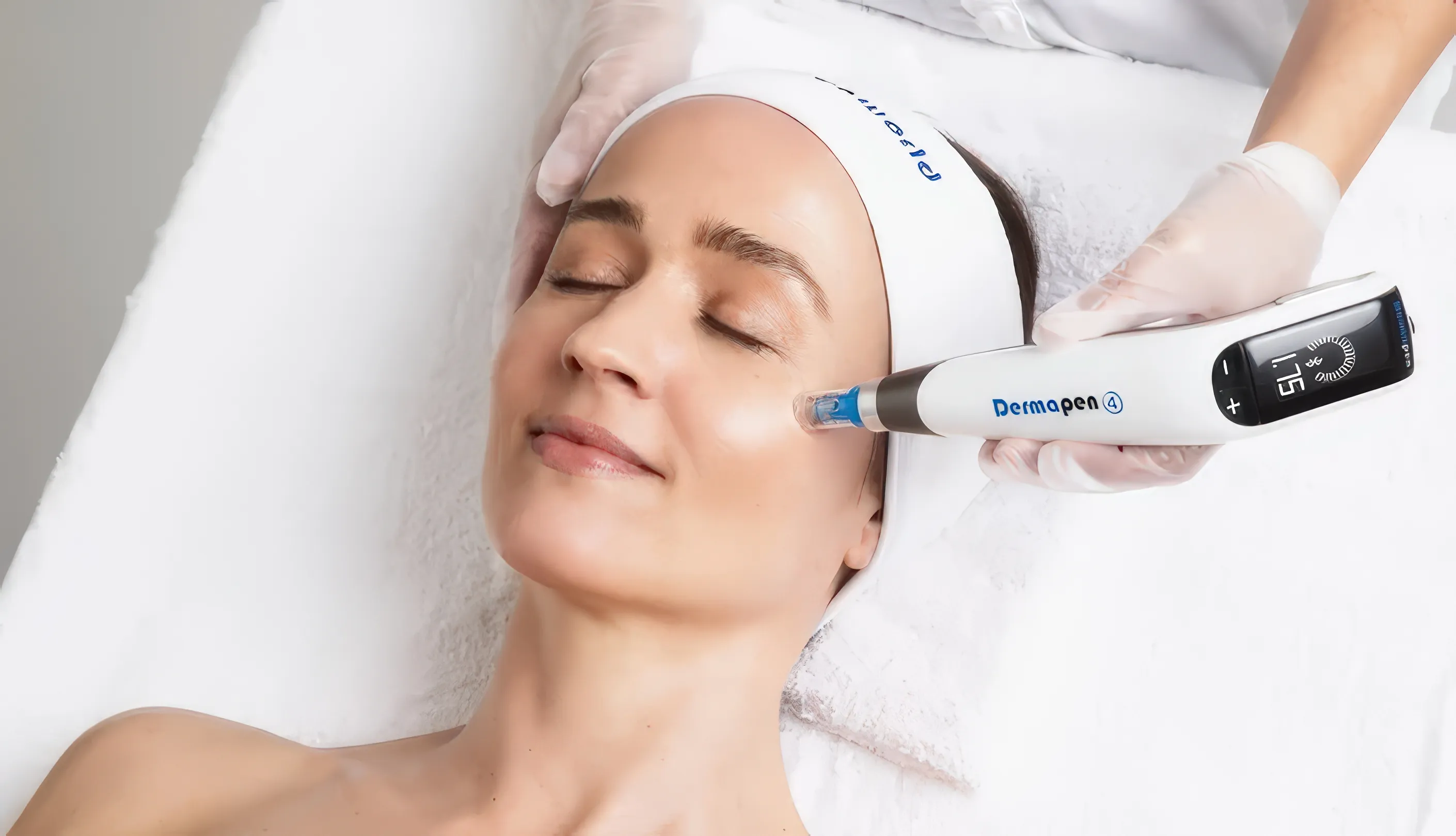 Dermapen - microneedling προσώπου